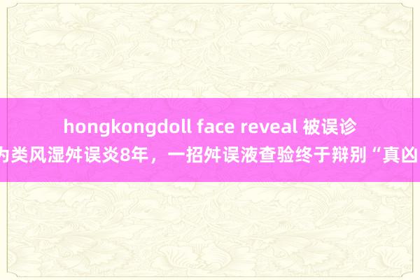 hongkongdoll face reveal 被误诊为类风湿舛误炎8年，一招舛误液查验终于辩别“真凶”